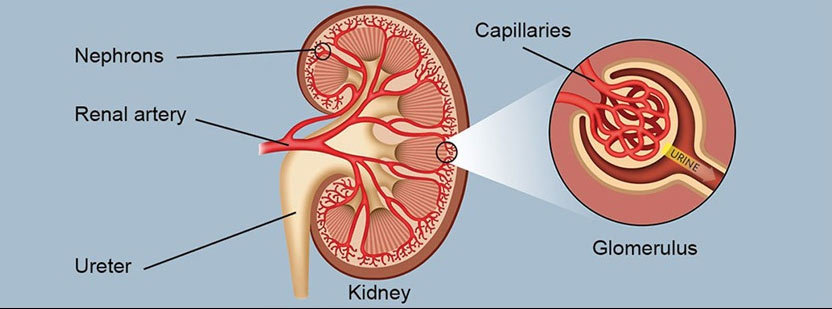 education-comprehensive-kidney-care-of-south-florida